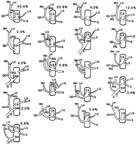 Image of variations in origin of right gastric artery