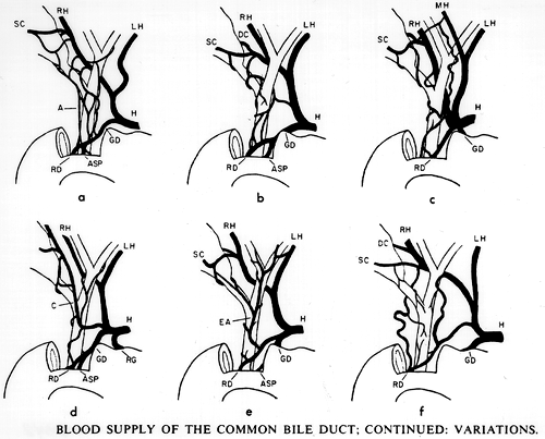 Image of variations in blood supply of common bile duct