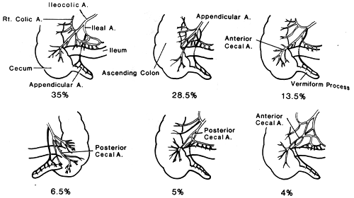 Image of major variations of appendiceal and cecal arteries