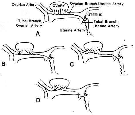 Image of variations in ovarian arterial supply