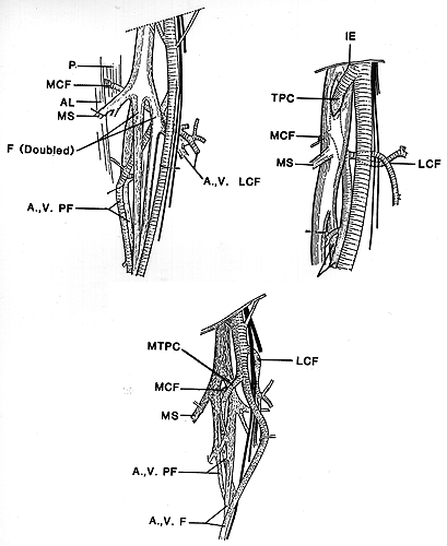 Image of femoral artery and branches