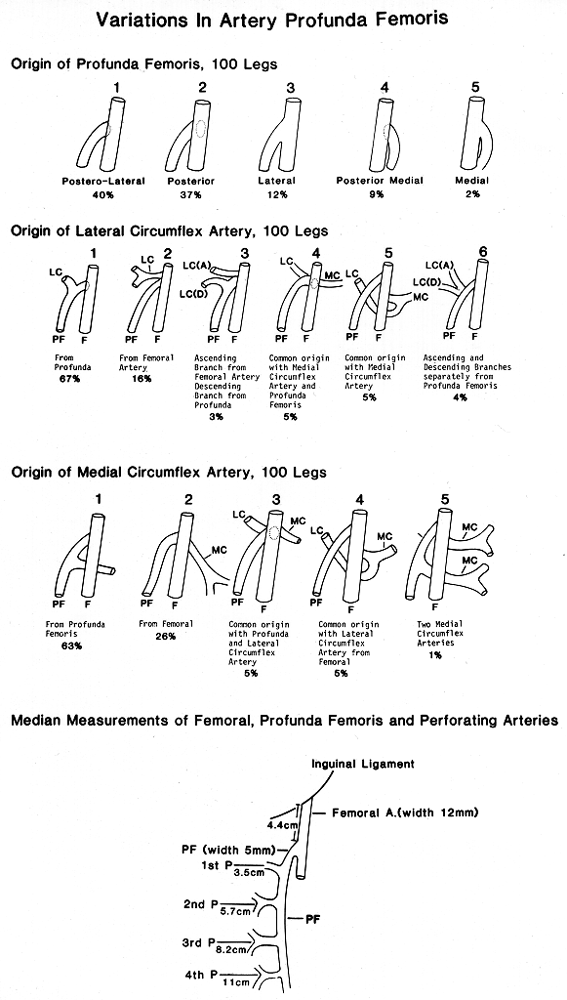 Image of variations in deep femoral artery