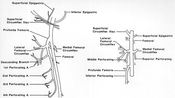 Image of femoral and profunda femoris arteries