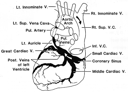 Image of closed coronary sinus