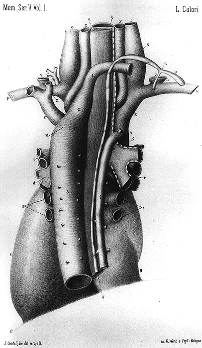 Image of anomalous thoracic duct emptying into right subclavian vein