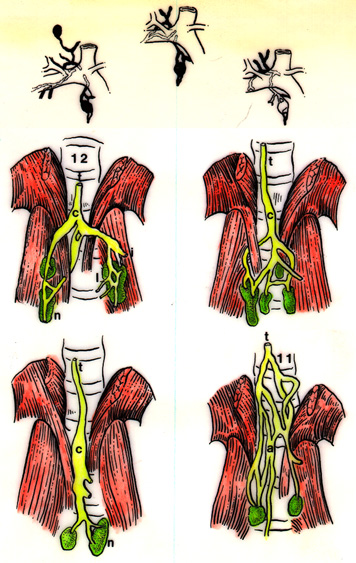 Image of termination of the thoracic duct on the right side