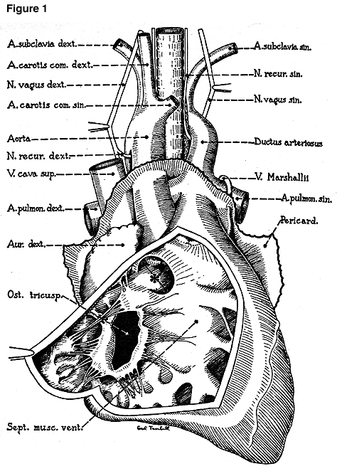 Image of right-sided aortic arch