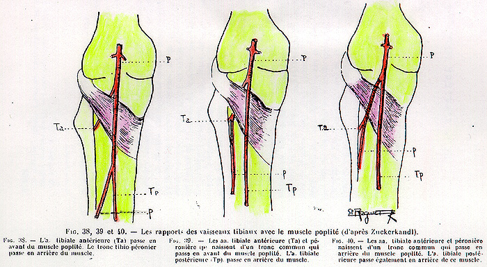 Image of relation between m. popliteus and arteries tibialis anterior and posterior