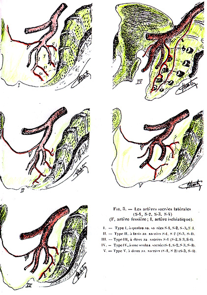 Image of lateral sacral arteries