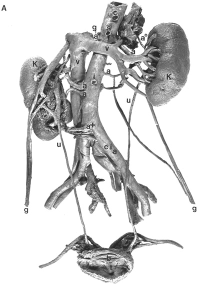 Image of multiple renal arteries
