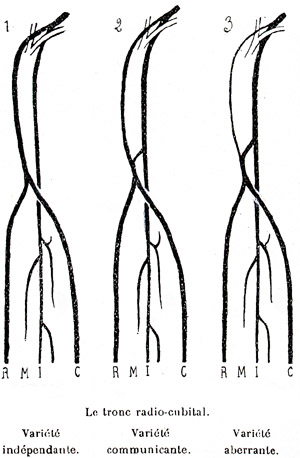Image of three types of radio-cubital trunk