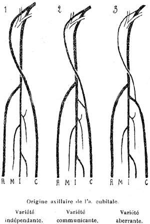 Image of axillary artery origin of the ulnar artery