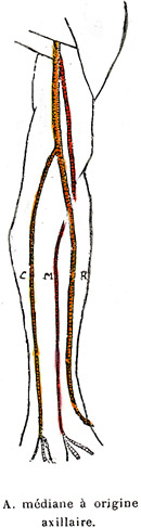 Image of median artery arising from the axillary artery