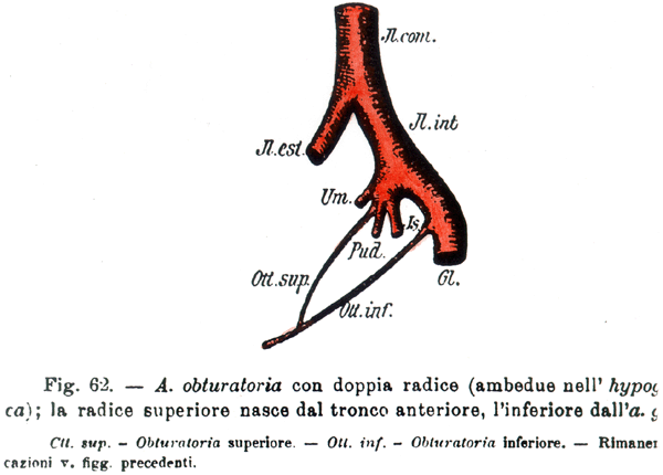 Obturator artery from two branches