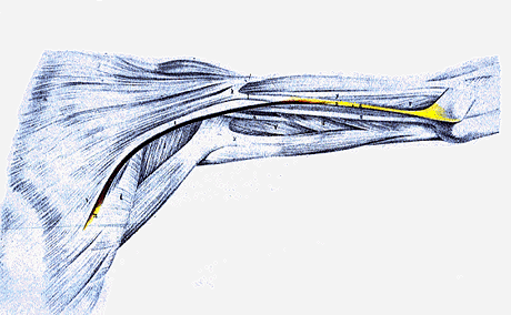 Image of chondoepitrochlearis