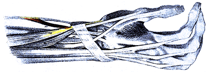 Image of accessory abductor pollicis longus