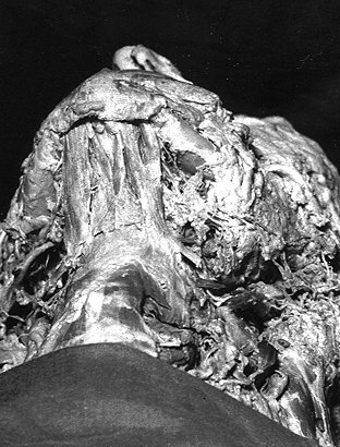 Image of anterior belly of digastricus