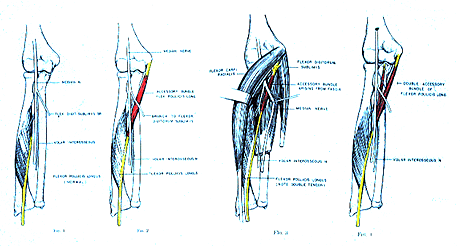 Image of varieties of gantzer's muscle