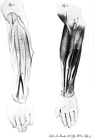 Image of varieties of palmaris longus