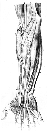 Image of irregular muscle fascicle from brachioradialis to antebracheal fascia