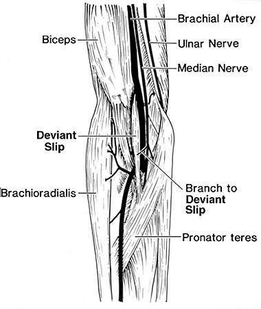 Image of pronator teres