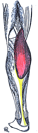 Image of absence of the lateral head of gastrocnemius