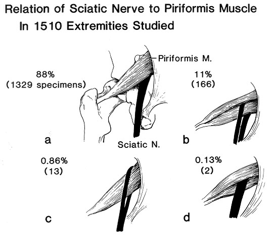 sciatic nerve treatment