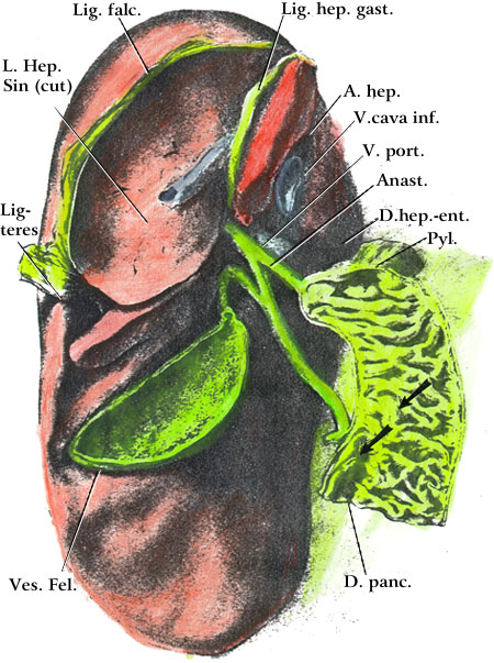 common bile duct anatomy. Duplication of Common Bile
