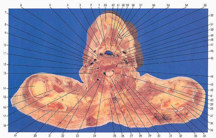 Neck Muscles Anatomy Cross Section