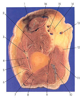 Plate 4.5