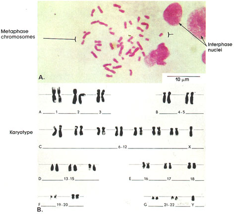 Plate 1.3: Chromosomes