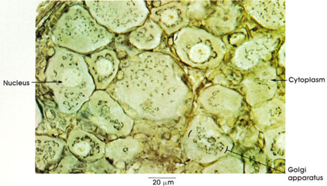 Plate 1.7: Golgi Apparatus