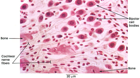 Plate 6.105 Spiral Ganglion Cells: Cochlear nerve
