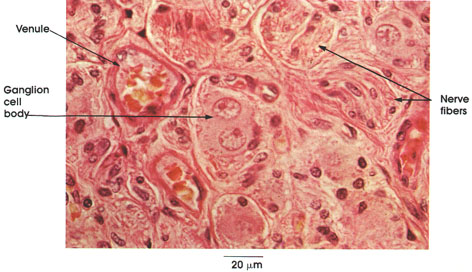 Plate 6.109 Parasympathetic Ganglion: Seminal Vesicle