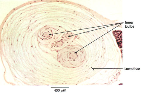 Plate 6.124 Corpuscle of Vater-Pacini