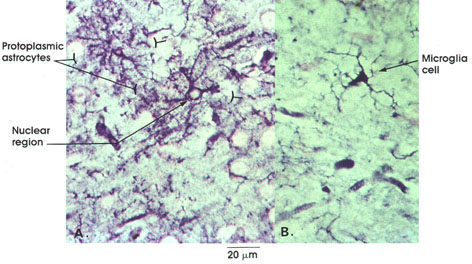 Plate 6.128 Neuroglia