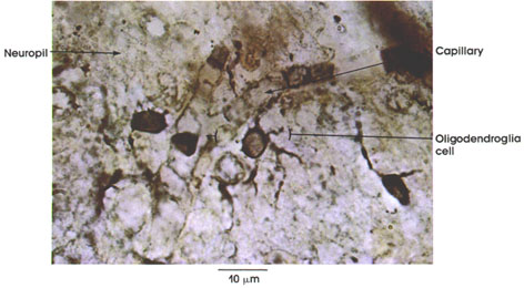 Plate 6.130 Neuroglia: Oligodendroglia