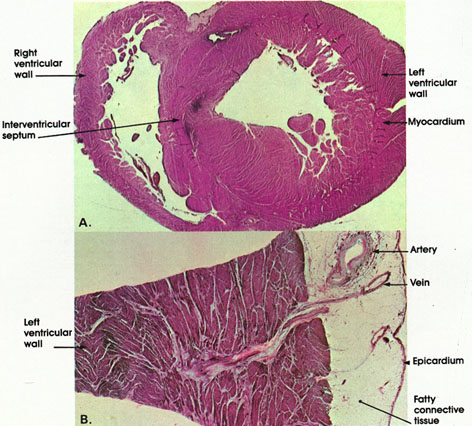 Plate 8.149 Heart: Ventrical Wall