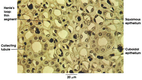 Plate 2.15: Squamous and Cuboidal Epithelial Cells