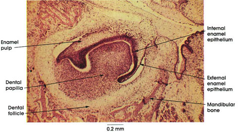 Plate 10.183 Developing Tooth