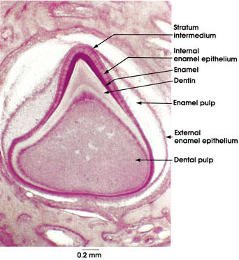 Plate 10.185 Developing Tooth