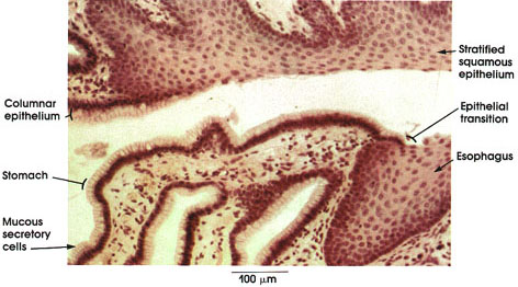 Plate 10.189 Esophagus-Stomach Junction