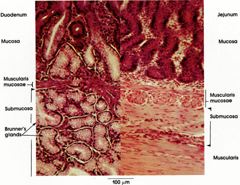 Plate 10.193 Duodenum and Jejunum