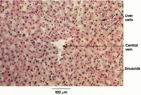 Plate 10.215 Liver