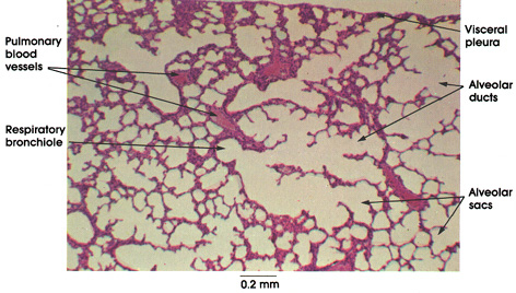 Plate 11.227 Lung