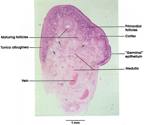 Plate 13.245 Ovary: Overview