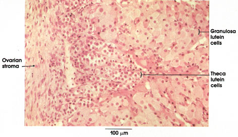 Plate 13.250 Corpus Luteum