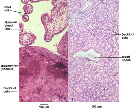 Plate 13.260 Placenta