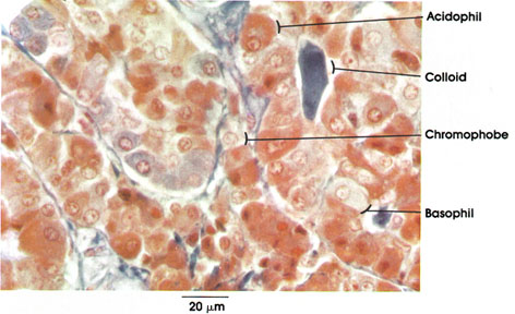 Plate 15.282 Pituitary Gland