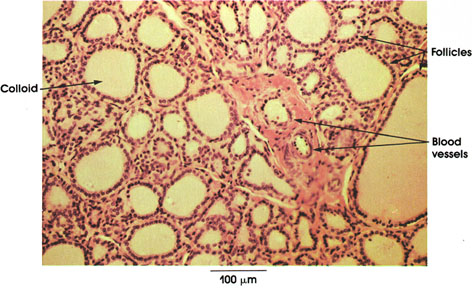 Plate 15.285 Thyroid Gland